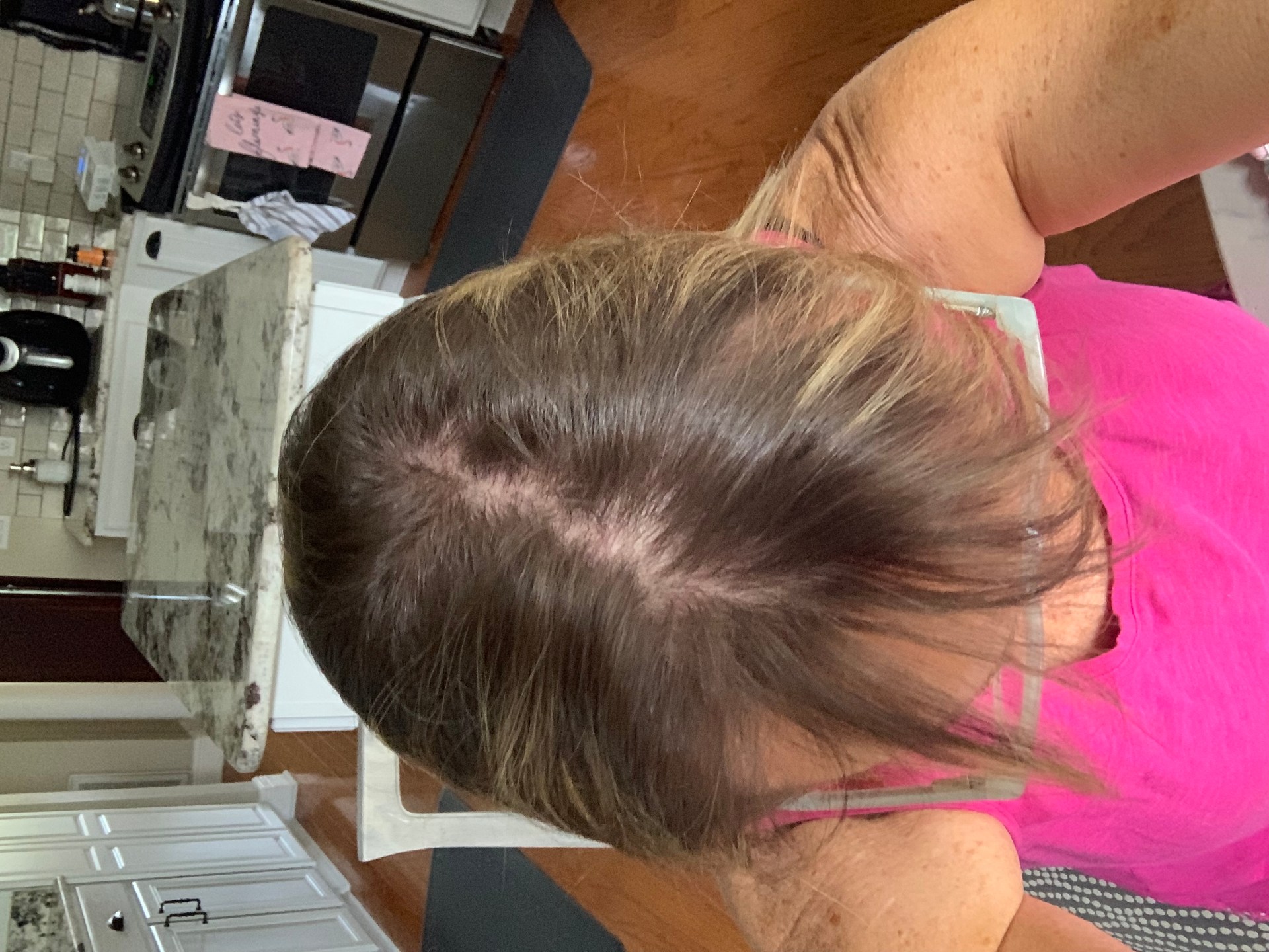 scalp hair growth